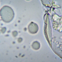Immune cell hunts down bacteria